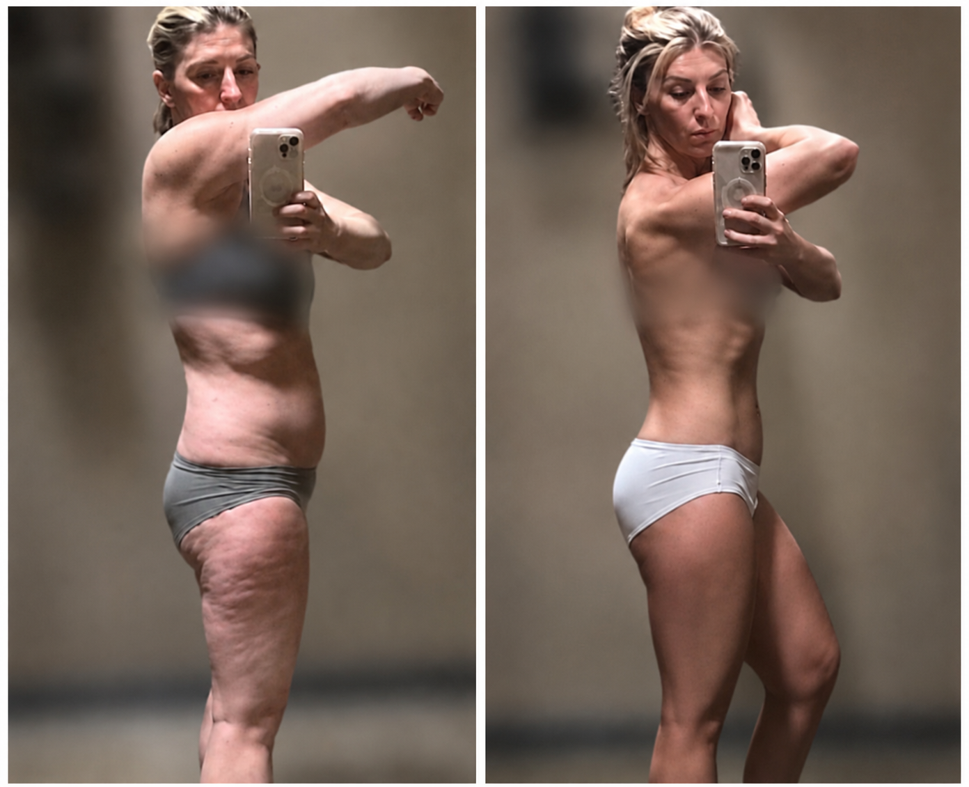 Patient transformation result — Evolve Weight™ at Evolution Wellness