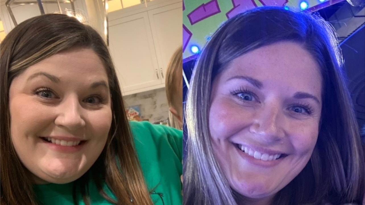 Patient transformation result — Evolve Weight™ at Evolution Wellness